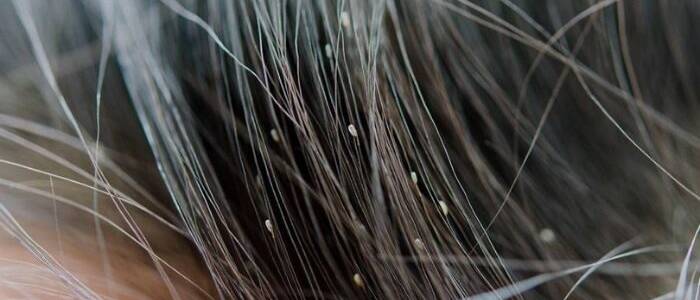 Obavijest roditeljima – uši